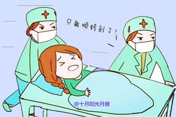 分娩順轉剖 千萬別緊張 十月陽光